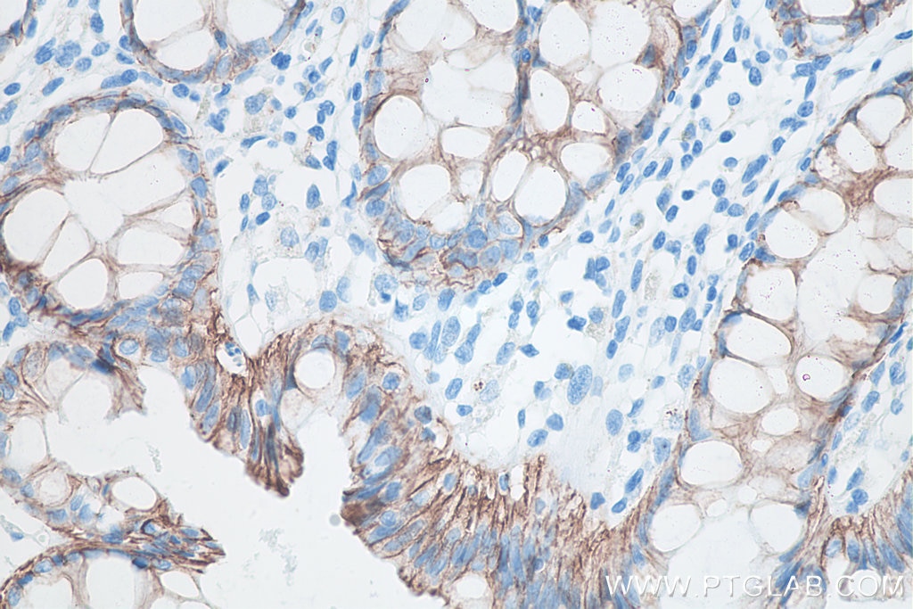Immunohistochemistry (IHC) staining of human colon tissue using Beta Catenin Monoclonal antibody (66379-1-Ig)
