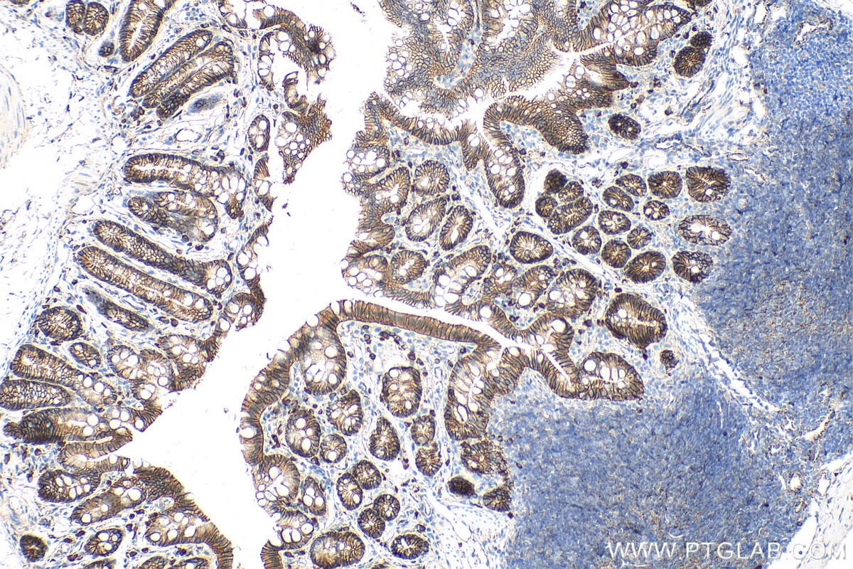Immunohistochemistry (IHC) staining of mouse colon tissue using Beta Catenin Monoclonal antibody (66379-1-Ig)