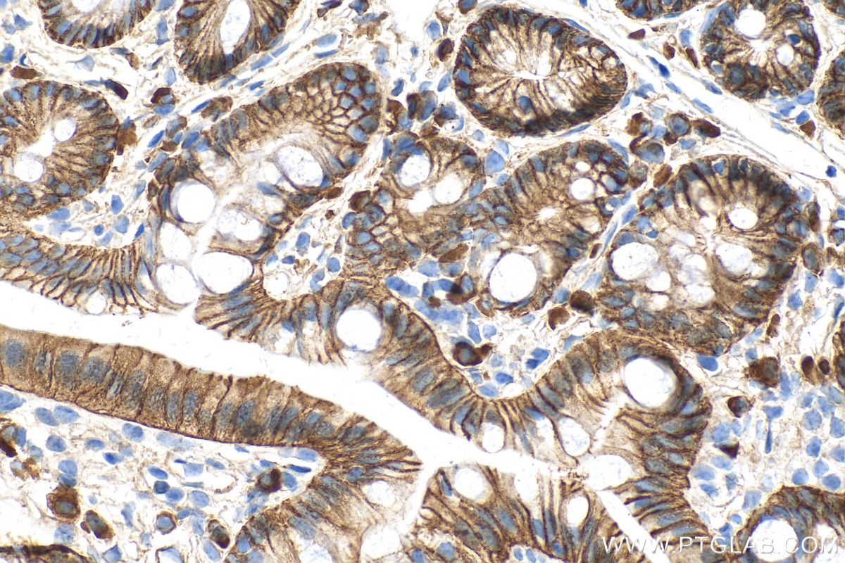 Immunohistochemistry (IHC) staining of mouse colon tissue using Beta Catenin Monoclonal antibody (66379-1-Ig)