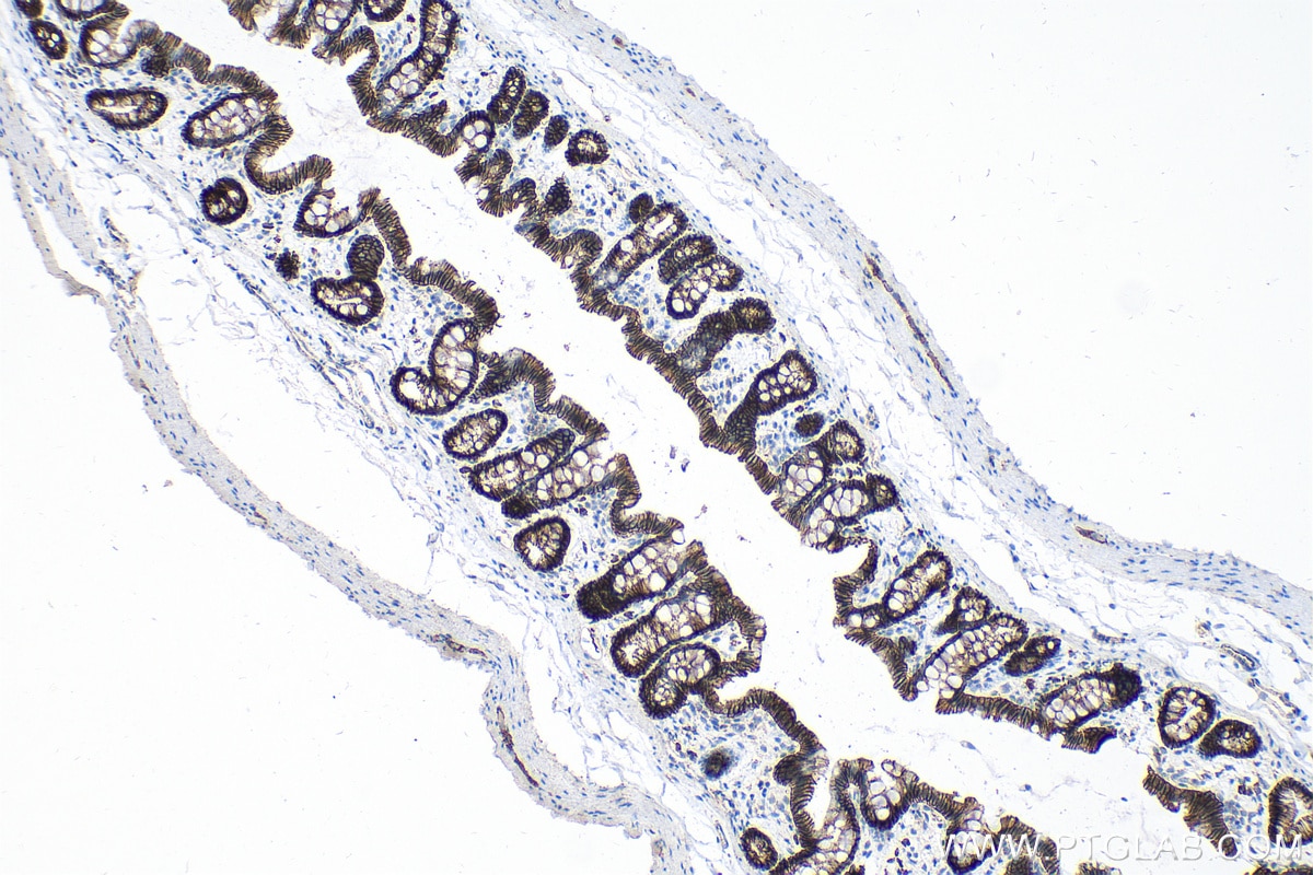Immunohistochemistry (IHC) staining of rat colon tissue using Beta Catenin Monoclonal antibody (66379-1-Ig)