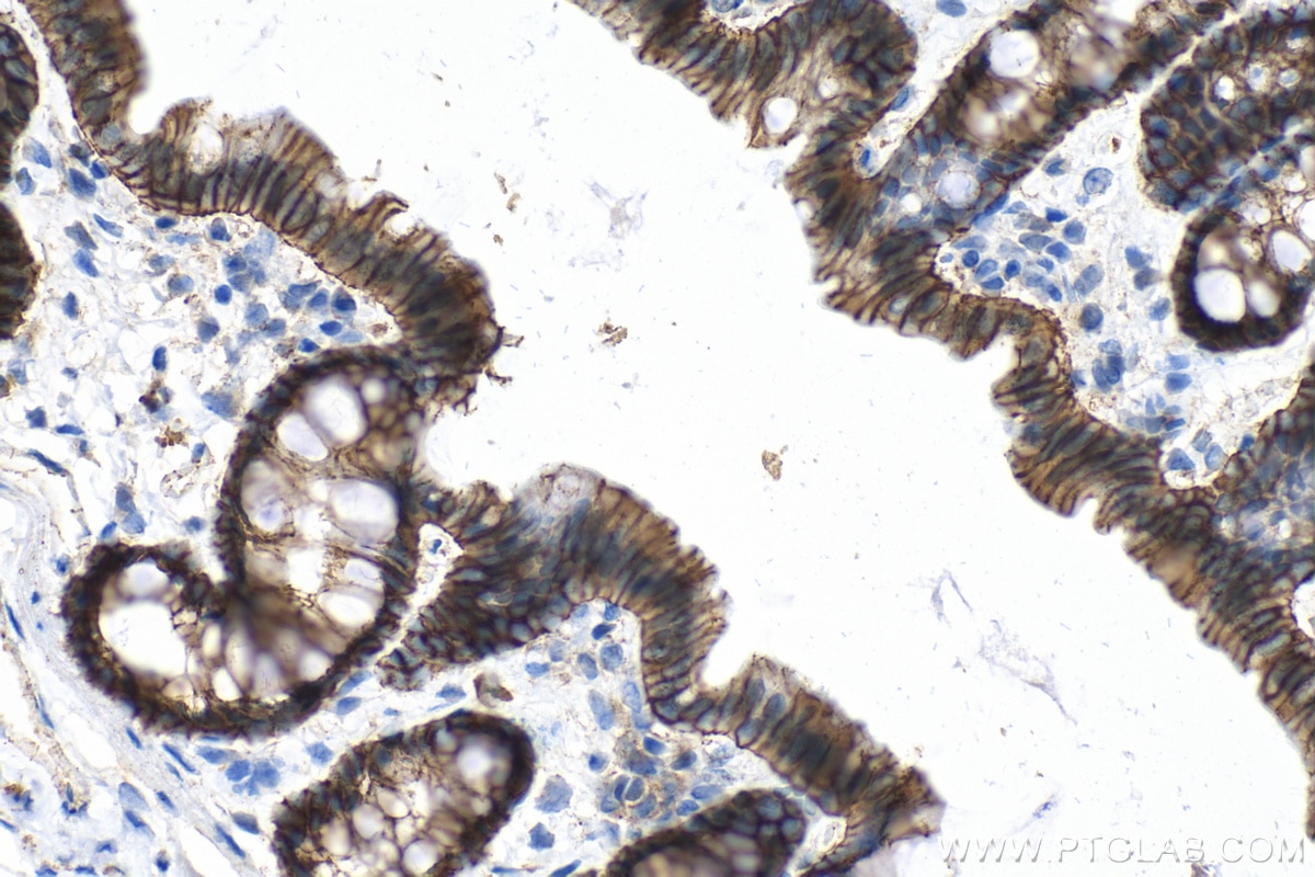 Immunohistochemistry (IHC) staining of rat colon tissue using Beta Catenin Monoclonal antibody (66379-1-Ig)