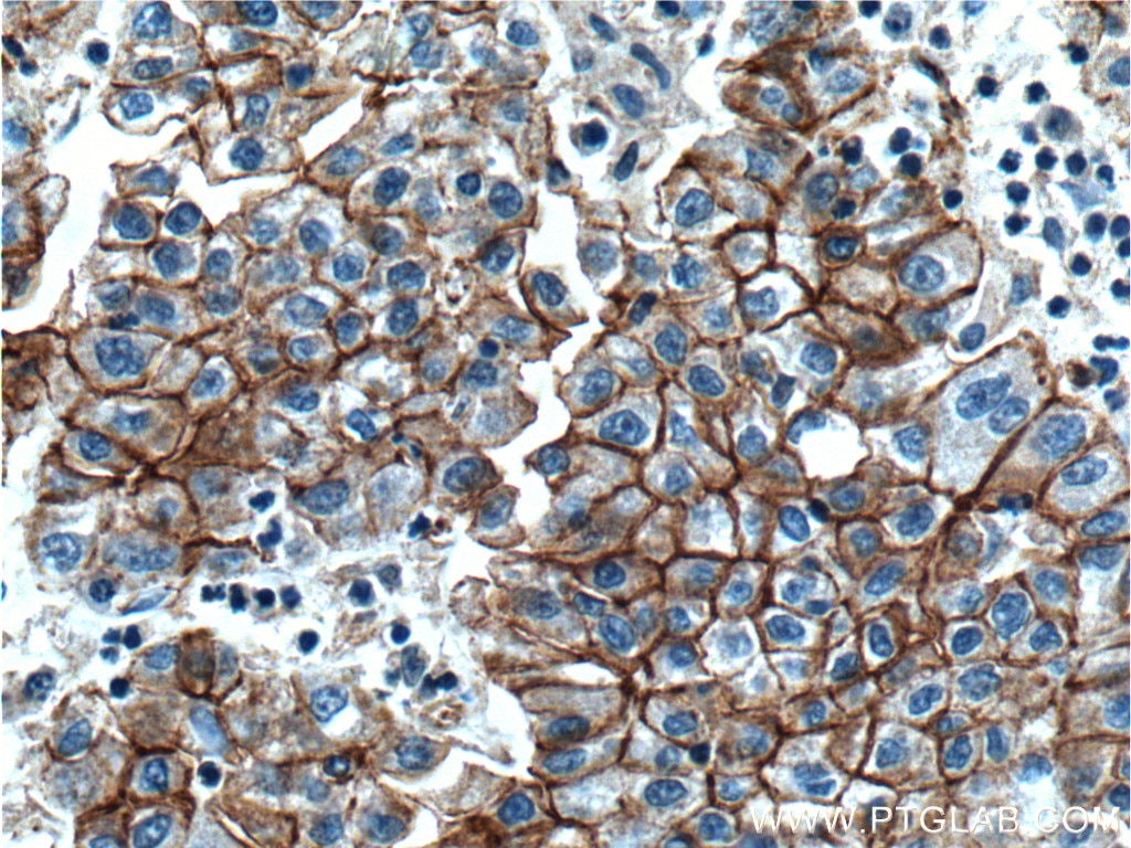 Beta Catenin Monoclonal antibody