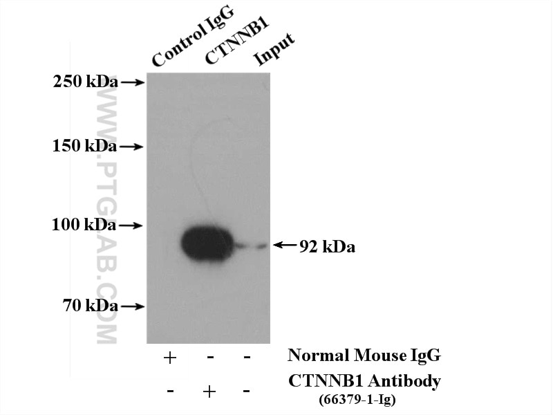 Immunoprecipitation (IP) experiment of mouse brain tissue using Beta Catenin Monoclonal antibody (66379-1-Ig)