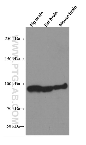 Western Blot (WB) analysis of various lysates using Beta Catenin Monoclonal antibody (66379-1-Ig)