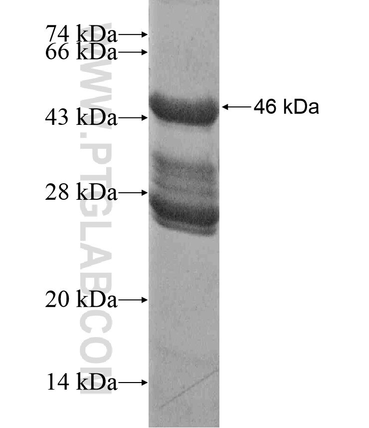CTNNB1 fusion protein Ag17524 SDS-PAGE
