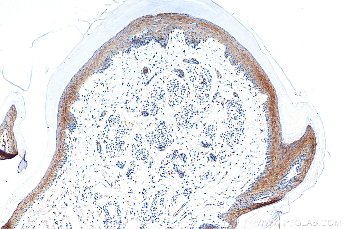 Immunohistochemistry (IHC) staining of mouse skin tissue using CTNNBIP1 Polyclonal antibody (18347-1-AP)