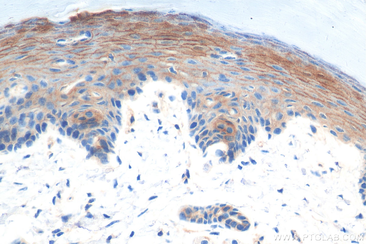 Immunohistochemistry (IHC) staining of mouse skin tissue using CTNNBIP1 Polyclonal antibody (18347-1-AP)