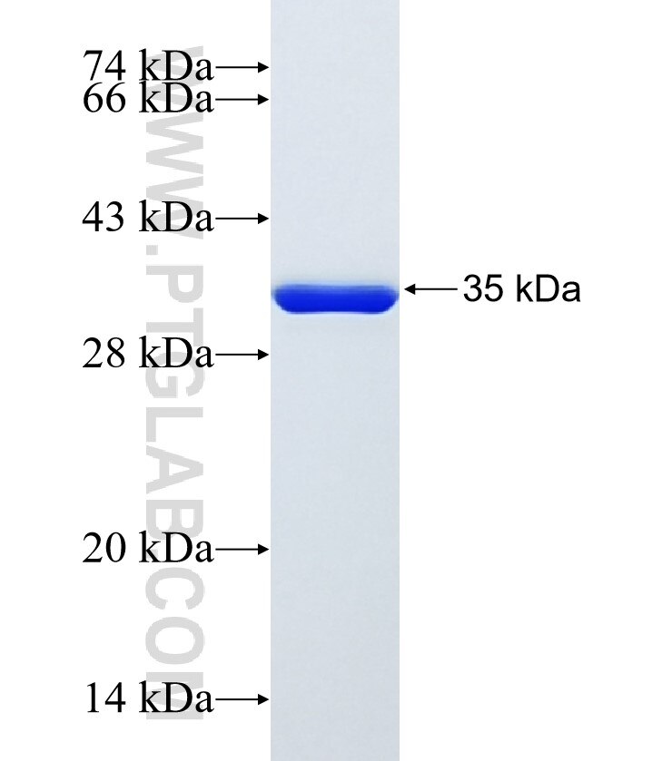 CTNNBIP1 fusion protein Ag13160 SDS-PAGE