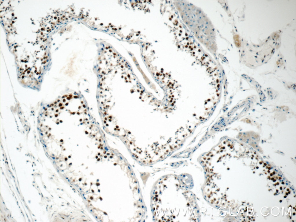 Immunohistochemistry (IHC) staining of human testis tissue using CTNNBL1 Polyclonal antibody (13665-1-AP)