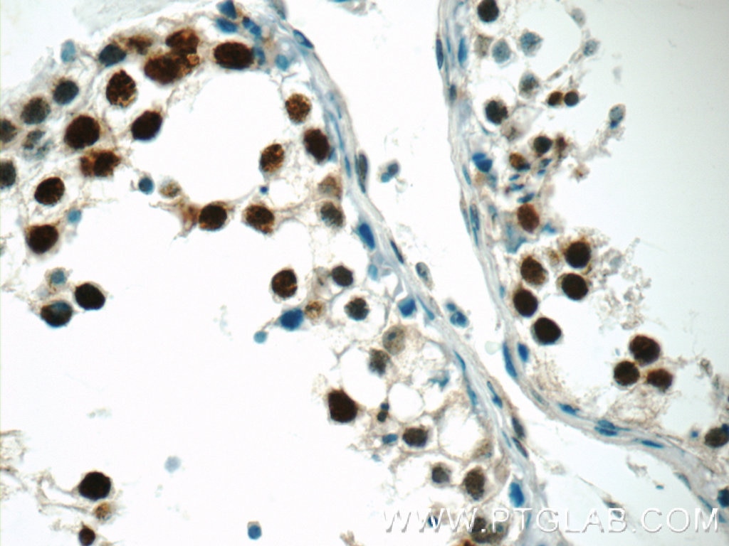 Immunohistochemistry (IHC) staining of human testis tissue using CTNNBL1 Polyclonal antibody (13665-1-AP)