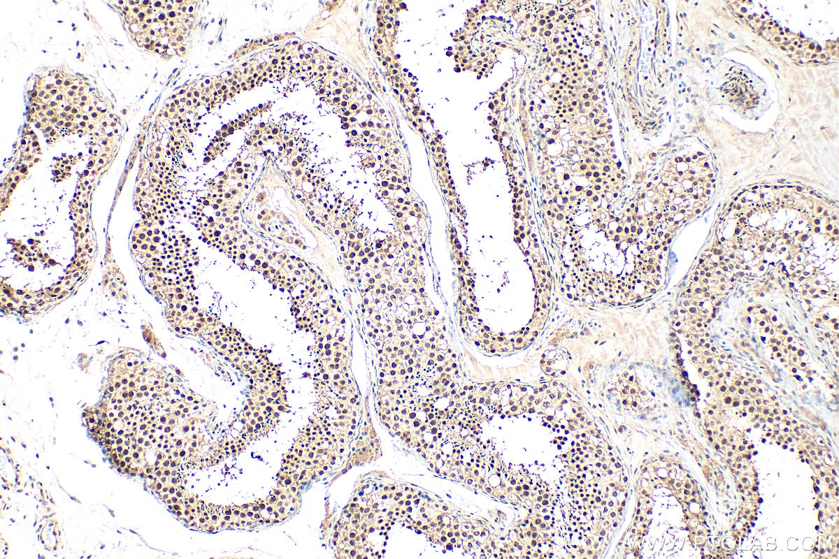 IHC staining of human testis using 13665-1-AP Immunohistochemistry (IHC) staining of human testis tissue using CTNNBL1 Polyclonal antibody (13665-1-AP)