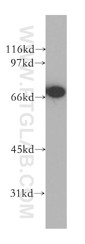 Western Blot (WB) analysis of Jurkat cells using CTNNBL1 Polyclonal antibody (13665-1-AP)
