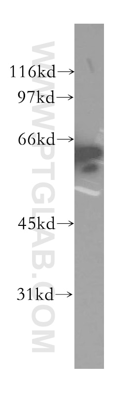 Western Blot (WB) analysis of mouse spleen tissue using CTNNBL1 Polyclonal antibody (13665-1-AP)