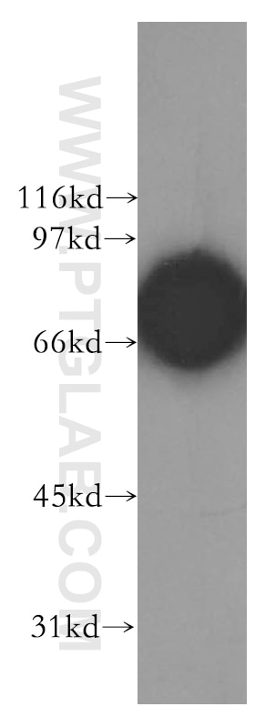 Western Blot (WB) analysis of mouse thymus tissue using CTNNBL1 Polyclonal antibody (13665-1-AP)