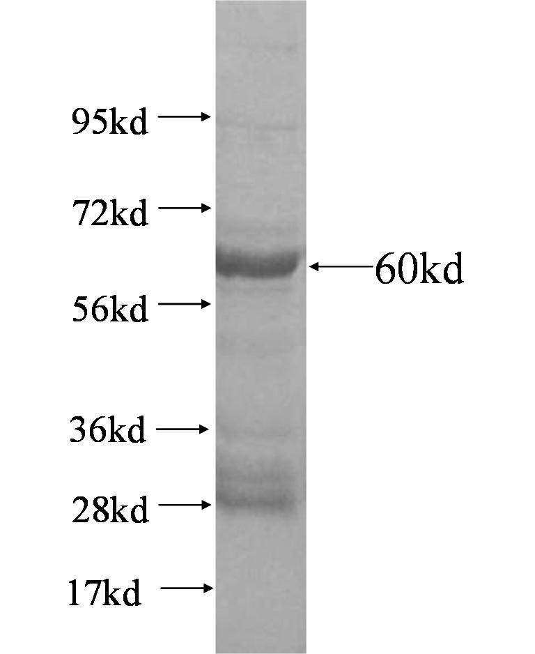 CTNNBL1 fusion protein Ag4578 SDS-PAGE