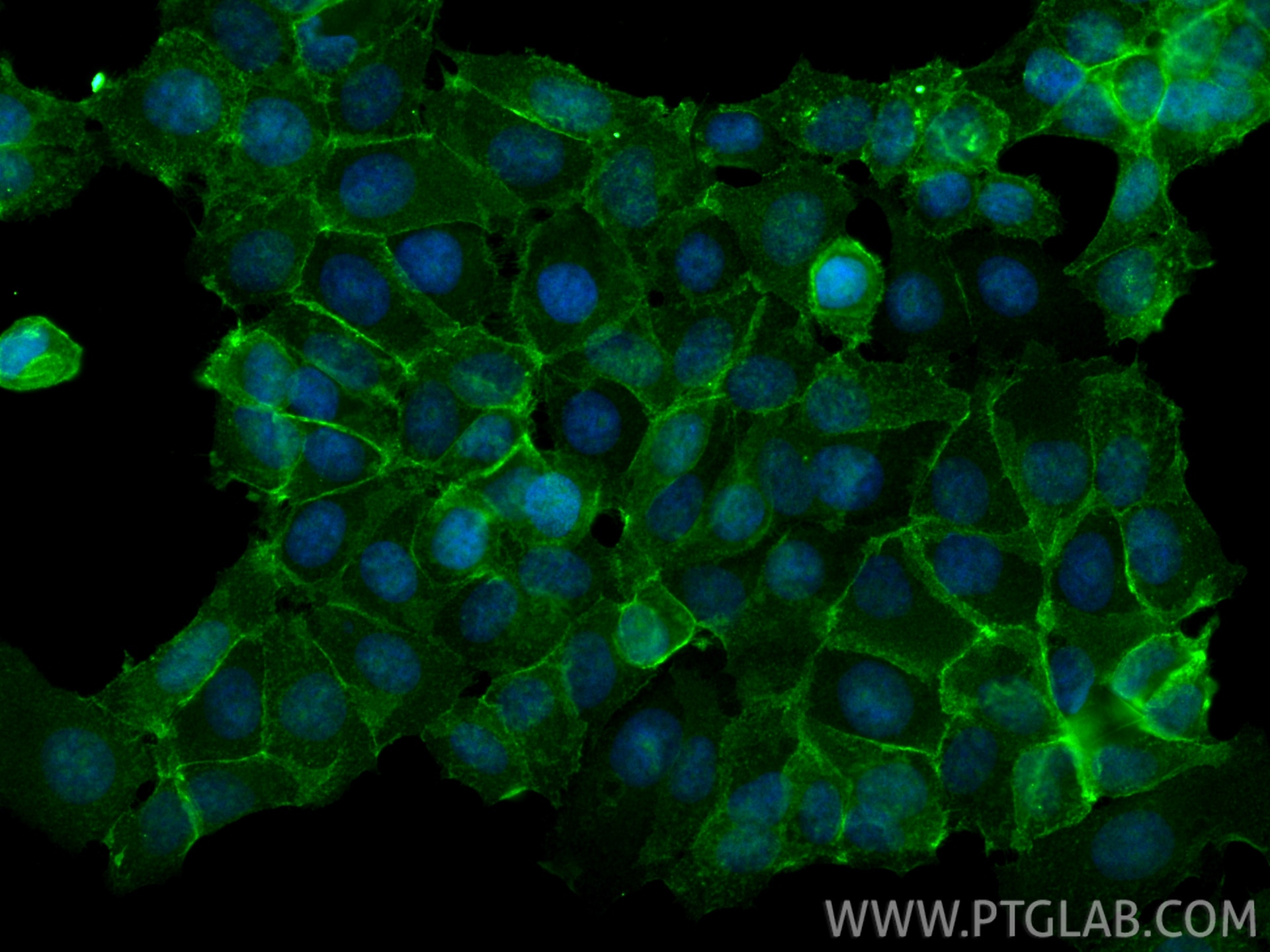 Immunofluorescence (IF) / fluorescent staining of MCF-7 cells using p120 Catenin Polyclonal antibody (12180-1-AP)