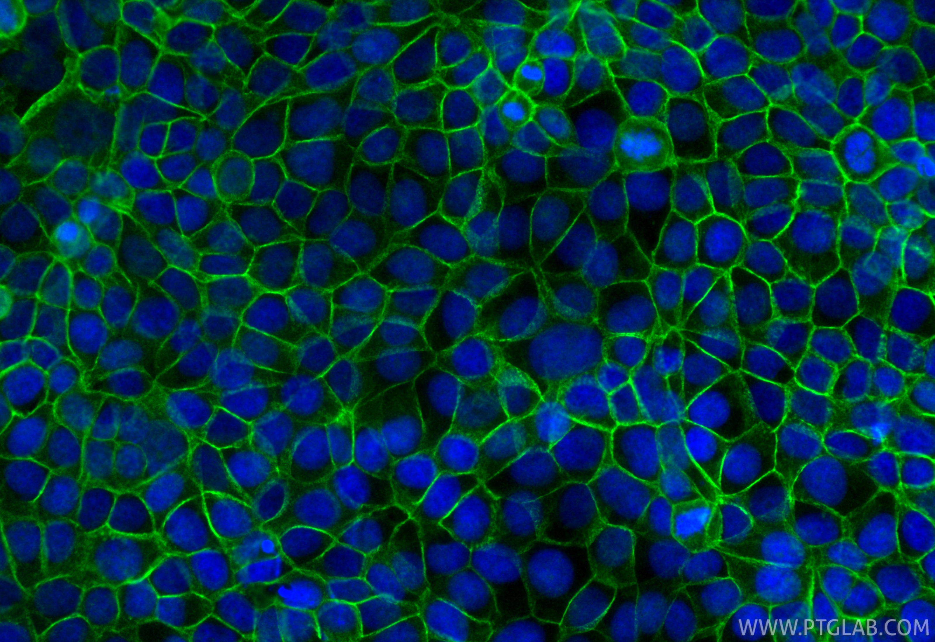 IF Staining of MCF-7 using 12180-1-AP Immunofluorescence (IF) / fluorescent staining of MCF-7 cells using p120 Catenin Polyclonal antibody (12180-1-AP)