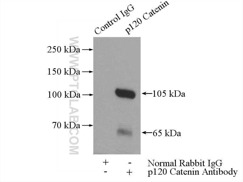 Immunoprecipitation (IP) experiment of mouse brain tissue using p120 Catenin Polyclonal antibody (12180-1-AP)