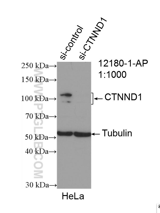 Western Blot (WB) analysis of HeLa cells using p120 Catenin Polyclonal antibody (12180-1-AP)