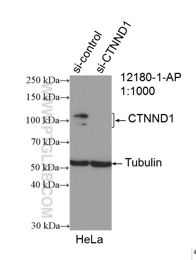 WB analysis of HeLa using 12180-1-AP