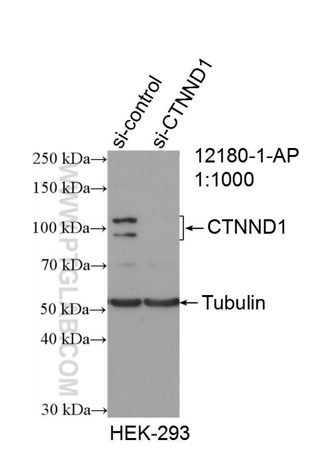 Western Blot (WB) analysis of HEK-293 cells using p120 Catenin Polyclonal antibody (12180-1-AP)