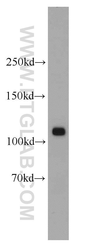 Western Blot (WB) analysis of human brain tissue using p120 Catenin Polyclonal antibody (12180-1-AP)