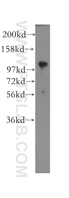 Western Blot (WB) analysis of human brain tissue using p120 Catenin Polyclonal antibody (12180-1-AP)