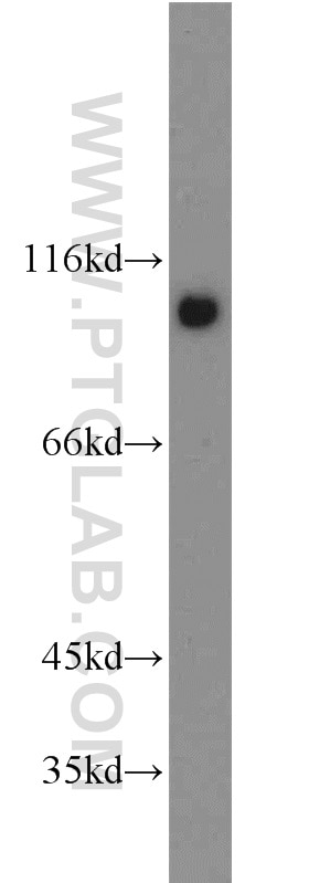 Western Blot (WB) analysis of mouse brain tissue using p120 Catenin Polyclonal antibody (12180-1-AP)