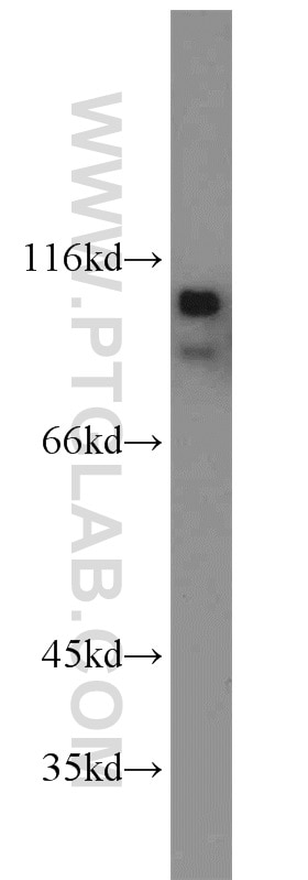 Western Blot (WB) analysis of NIH/3T3 cells using p120 Catenin Polyclonal antibody (12180-1-AP)