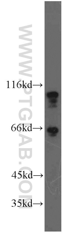 Western Blot (WB) analysis of RAW264.7 using p120 Catenin Polyclonal antibody (12180-1-AP)