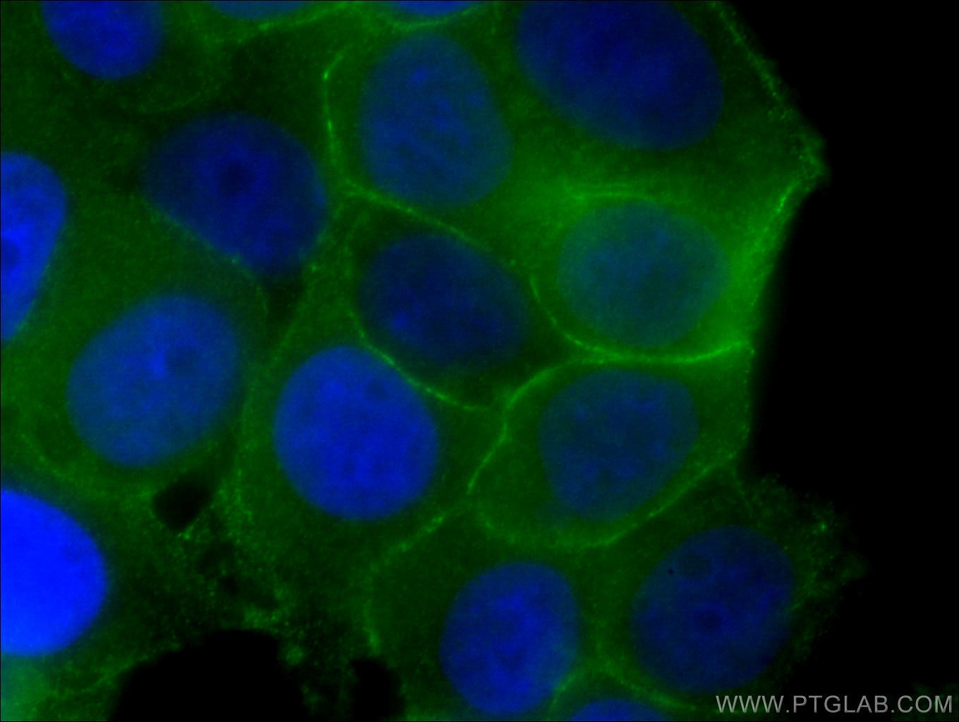 Immunofluorescence (IF) / fluorescent staining of MCF-7 cells using p120 Catenin Monoclonal antibody (66208-1-Ig)