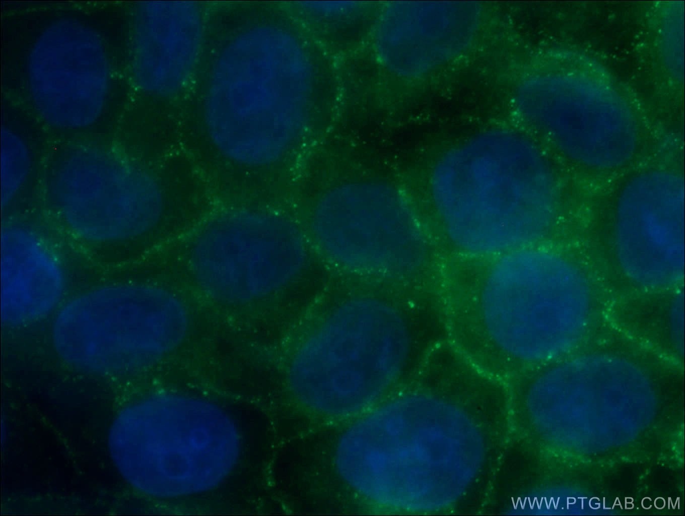 Immunofluorescence (IF) / fluorescent staining of HeLa cells using p120 Catenin Monoclonal antibody (66208-1-Ig)