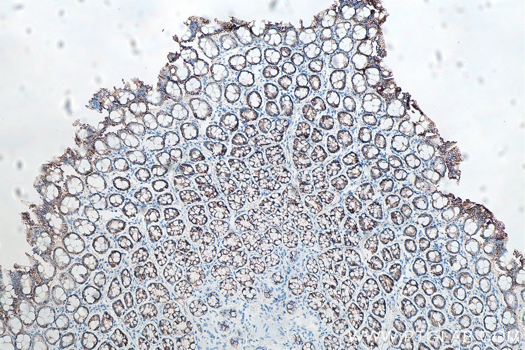 Immunohistochemistry (IHC) staining of rat colon tissue using p120 Catenin Monoclonal antibody (66208-1-Ig)