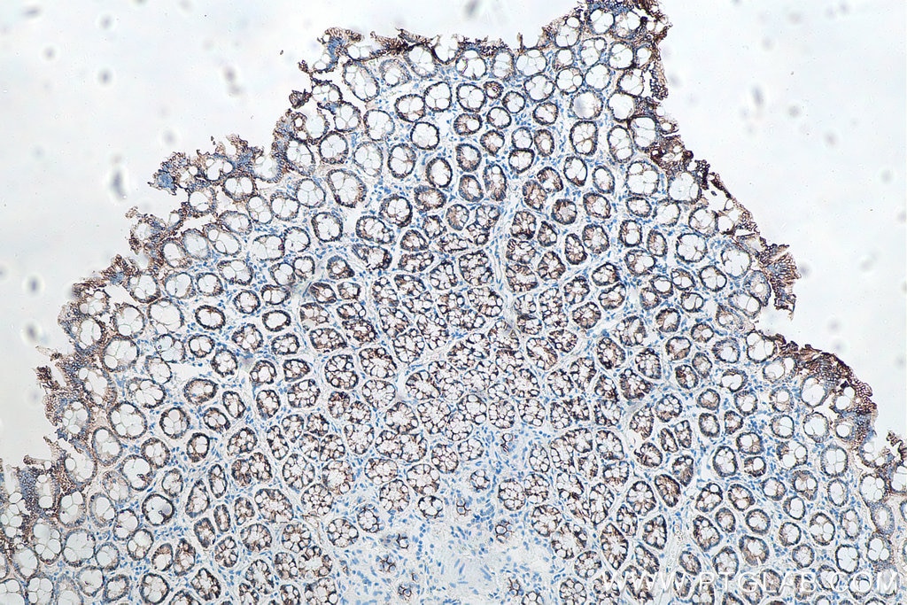 IHC staining of rat colon using 66208-1-Ig