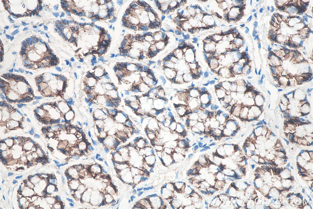Immunohistochemistry (IHC) staining of rat colon tissue using p120 Catenin Monoclonal antibody (66208-1-Ig)