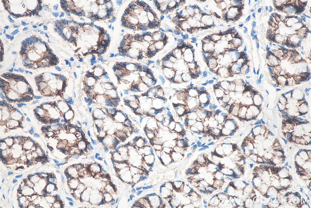 IHC staining of rat colon using 66208-1-Ig