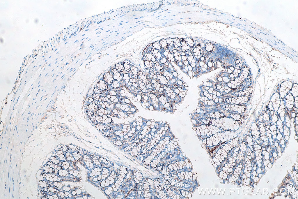 Immunohistochemistry (IHC) staining of mouse colon tissue using p120 Catenin Monoclonal antibody (66208-1-Ig)