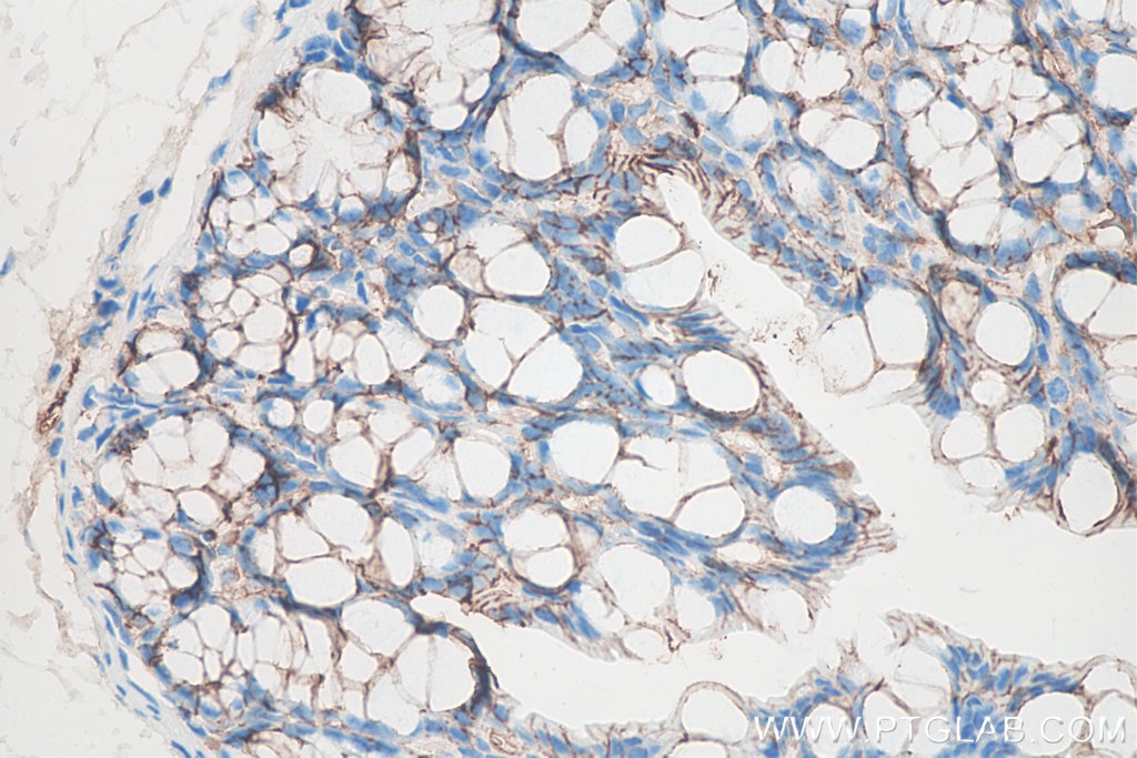 Immunohistochemistry (IHC) staining of mouse colon tissue using p120 Catenin Monoclonal antibody (66208-1-Ig)