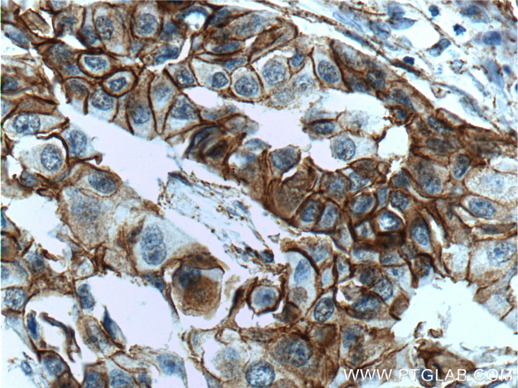 p120 Catenin Monoclonal antibody