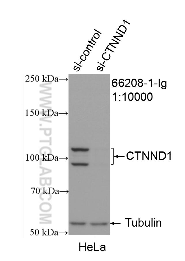 Western Blot (WB) analysis of HeLa cells using p120 Catenin Monoclonal antibody (66208-1-Ig)