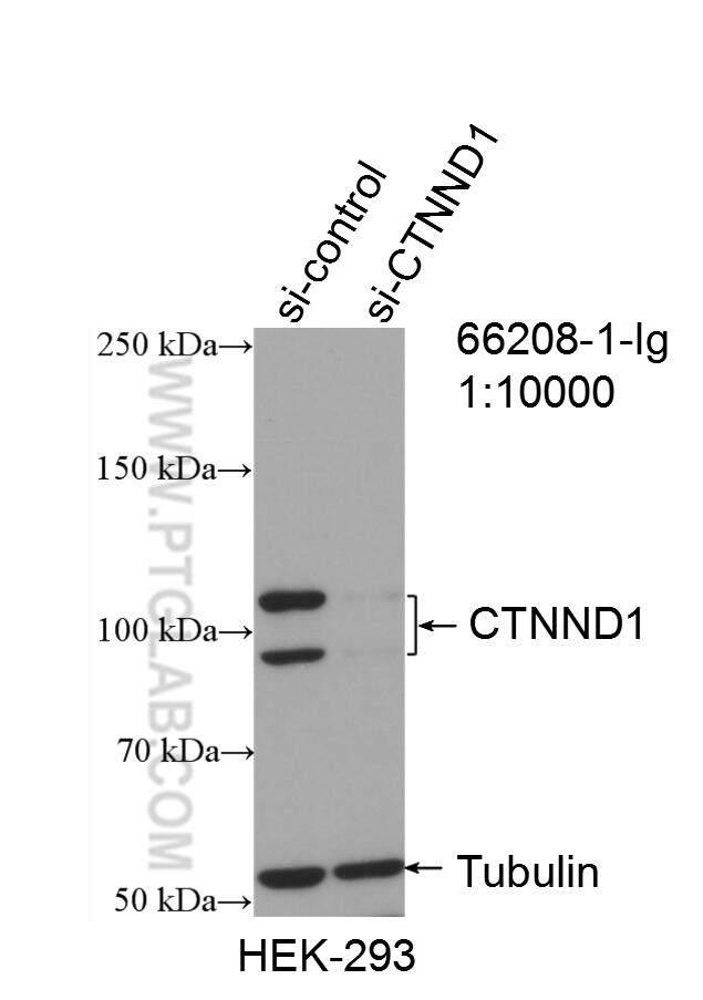 Western Blot (WB) analysis of HEK-293 cells using p120 Catenin Monoclonal antibody (66208-1-Ig)
