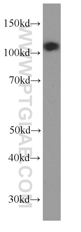 Western Blot (WB) analysis of fetal human brain tissue using p120 Catenin Monoclonal antibody (66208-1-Ig)