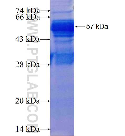CTNND1 fusion protein Ag2824 SDS-PAGE