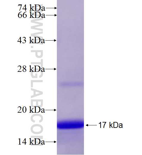CTNND2 fusion protein Ag28041 SDS-PAGE