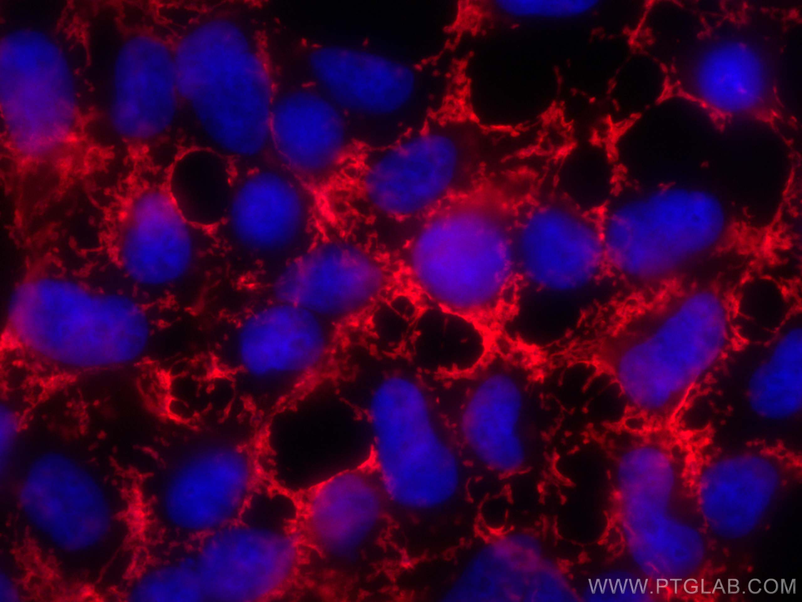 Immunofluorescence (IF) / fluorescent staining of HEK-293 cells using CTNS Polyclonal antibody (13085-1-AP)
