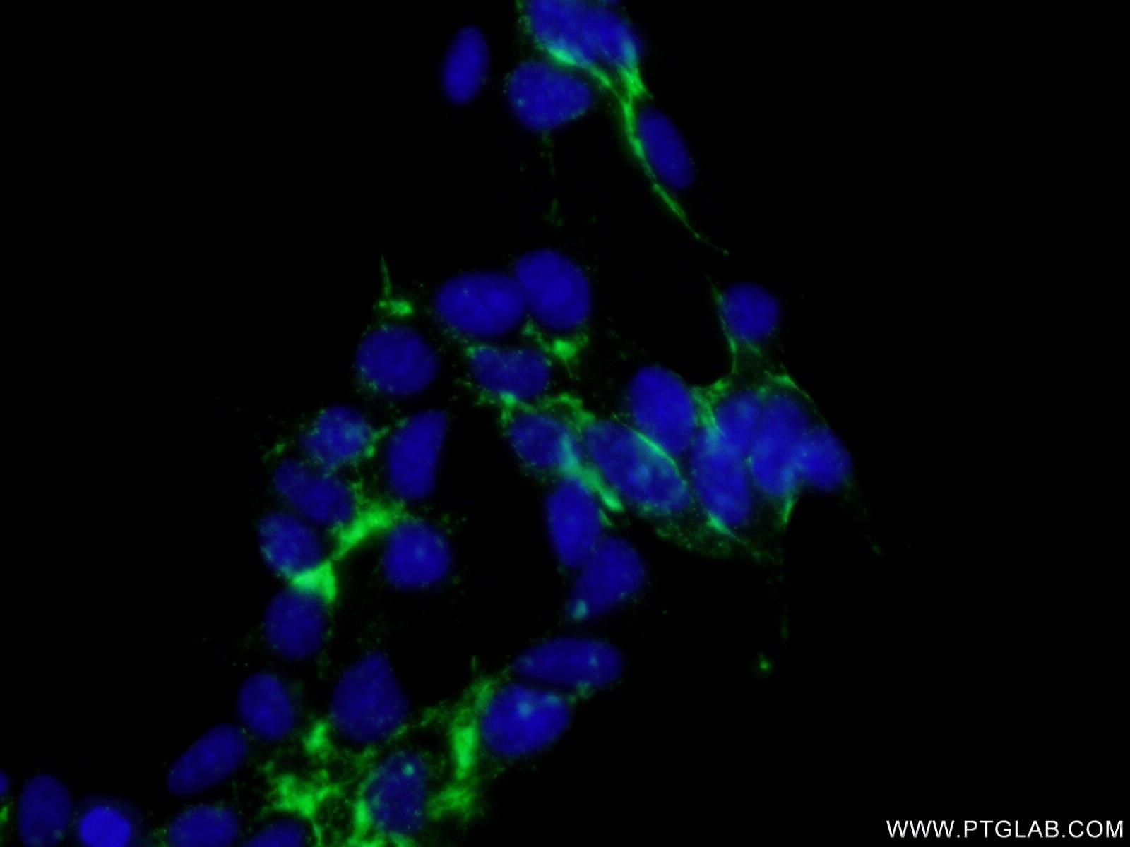 Immunofluorescence (IF) / fluorescent staining of HEK-293 cells using CTNS Polyclonal antibody (13085-1-AP)