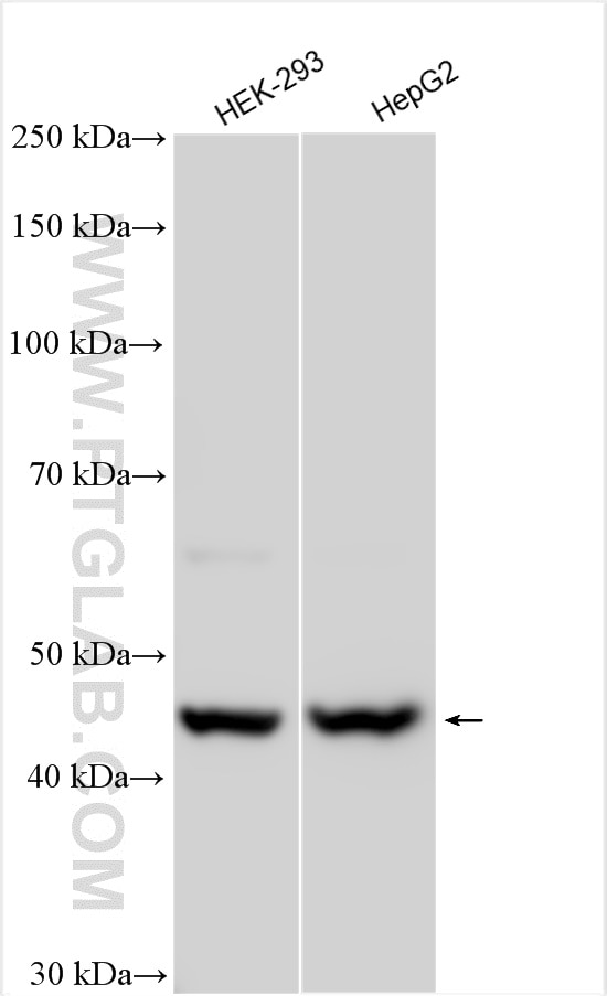 Western Blot (WB) analysis of various lysates using CTNS Polyclonal antibody (13085-1-AP)