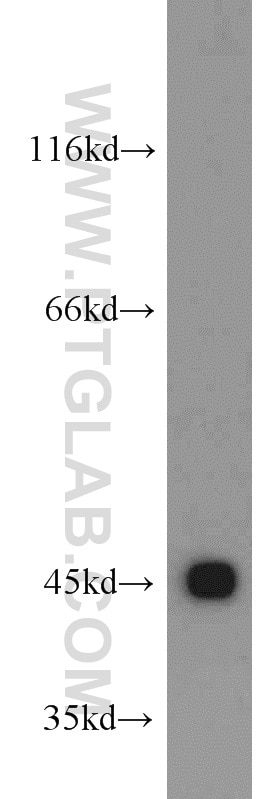 Western Blot (WB) analysis of HEK-293 cells using CTNS Polyclonal antibody (13085-1-AP)