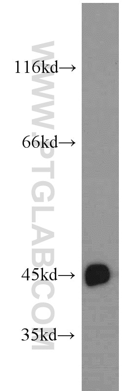 Western Blot (WB) analysis of HeLa cells using CTNS Polyclonal antibody (13085-1-AP)