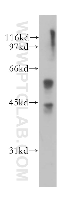 Western Blot (WB) analysis of HEK-293 cells using CTNS Polyclonal antibody (13085-1-AP)